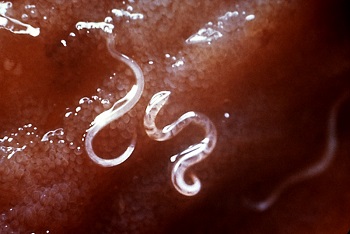 parasiten hakenwurm